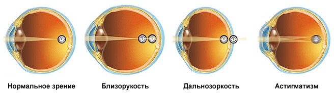 Центр микрохирургии глаза и лазерных методов лечения